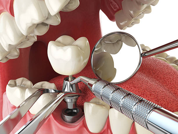 Best Emergency Treatment for Oral Infections in Ponca City, OK