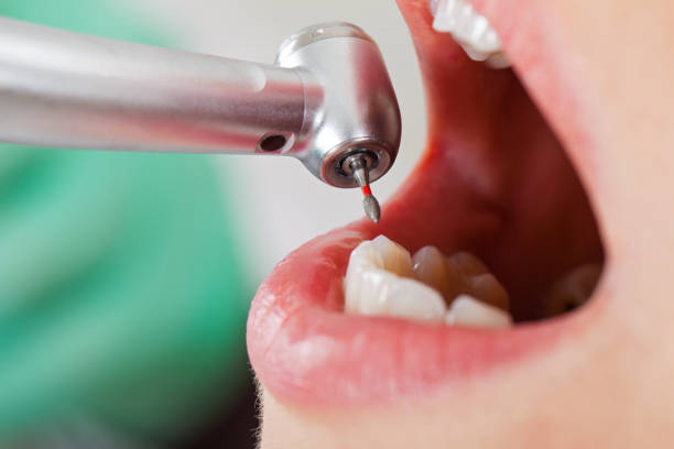 Best Broken or Chipped Tooth Repair in Ponca City, OK